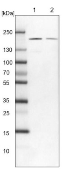 USP47 Antibody, Novus Biologicals:Antibodies:Primary Antibodies